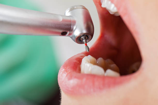 Best Pediatric Emergency Dentist in Victorville, CA